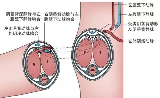 男性生殖器最新图片，探索生理构造与健康知识